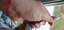 Фото-отзыв №3 Дермедик Точечный гель для проблемной кожи, 15 мл (Dermedic, Normacne), автор Сагитдинова Регина