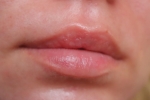 Фото-отзыв №2 Блистекс Крем для губ смягчающий Lip Relief Cream SPF 15, 6 мл (Blistex, Уход за губами), автор Оксана