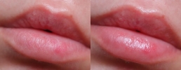Фото-отзыв №2 Блистекс Бальзам для губ Lip Medex, 7 г (Blistex, Уход за губами), автор Оксана