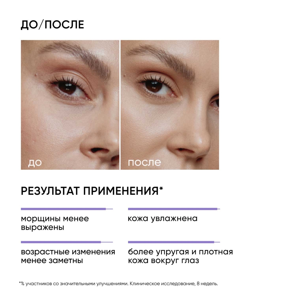 Ночной крем для кожи вокруг глаз Age Eraser на основе 0,05% ретинола, 20 мл
