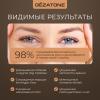 Массажер-очки для глаз ISee410 3D Relax