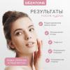 Маска миостимулятор для лица Biolift iFace