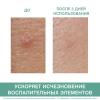 Паста SOS-Уход, 15 г