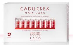 Лосьон при средней стадии выпадения волос у женщин Advanced Hair Loss, №20