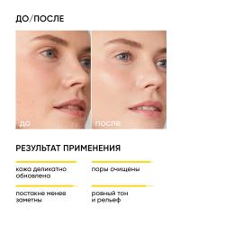 Очищающий гель для умывания с кислотами Soft Renew, 150 мл