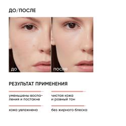 Корректирующая крем-сыворотка на основе 10% азелаиновой кислоты, 50 мл