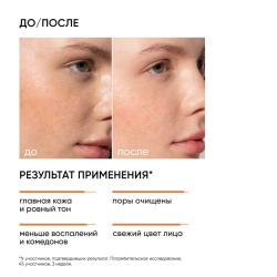 Отшелушивающий тоник с миндальной кислотой, 150 мл