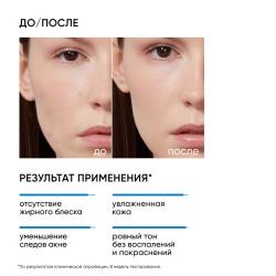 Увлажняющий крем для кожи, склонной к акне Moist & Heal, 50 мл