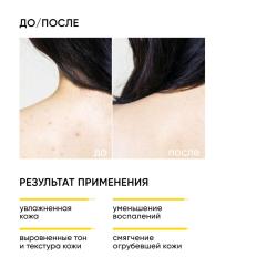 Обновляющий крем для тела с кислотами Skin Renewal, 200 мл