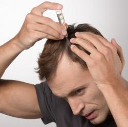 Лосьон для возобновления роста волос у мужчин Transdermic Re-Growth HFSC, №40