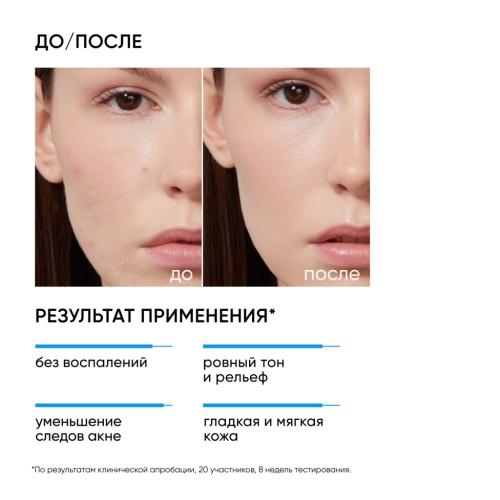Айкон Скин Пилинг для проблемной кожи 18%, 30 мл (Icon Skin, Re:Program), фото-3