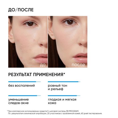 Айкон Скин Пилинг для проблемной кожи 11%, 30 мл (Icon Skin, Re:Program), фото-3