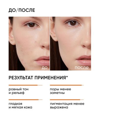 Айкон Скин Миндальный пилинг 12%, 30 мл (Icon Skin, Smart), фото-3