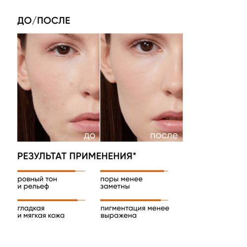Айкон Скин Интенсивный миндальный пилинг 25% , 30 мл (Icon Skin, Smart), фото-3
