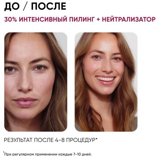 Айкон Скин Набор: Омолаживающий пилинг и нейтрализующий лосьон, 30% AHA (Icon Skin, Professional Series), фото-4