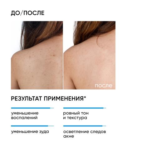 Айкон Скин Сыворотка-спрей Acne Free Solution, 100 мл (Icon Skin, Re:Program), фото-3