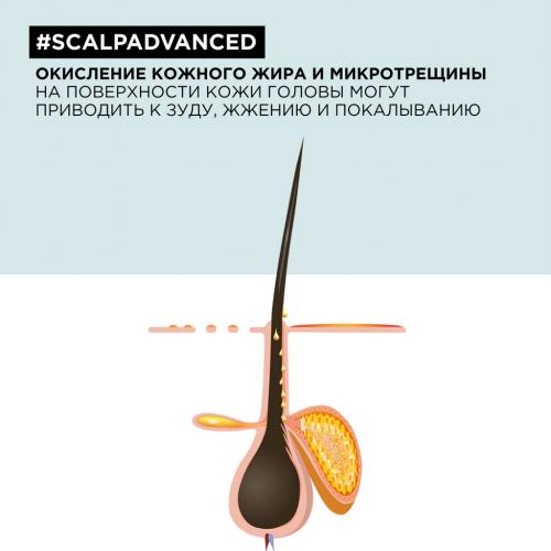 Лореаль Профессионель Шампунь Scalp Advanced регулирующий баланс чувствительной кожи головы, 300 мл (L'Oreal Professionnel, Уход за волосами, Scalp Care), фото-5