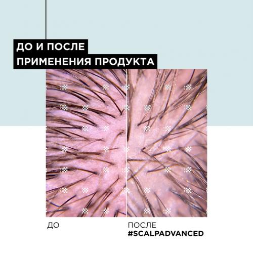 Лореаль Профессионель Шампунь Scalp Advanced регулирующий баланс чувствительной кожи головы, 300 мл (L'Oreal Professionnel, Уход за волосами, Scalp Care), фото-10