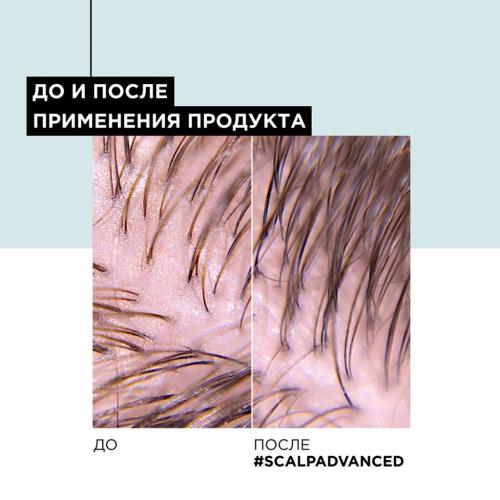 Лореаль Профессионель Шампунь-маска 2-в-1 Scalp Advanced для жирной кожи головы, 250 мл (L'Oreal Professionnel, Уход за волосами, Scalp Care), фото-9