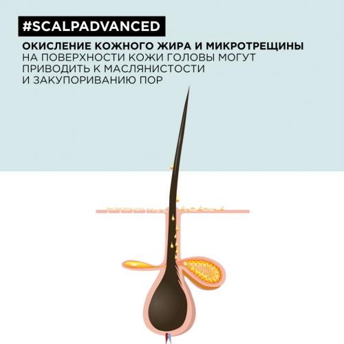 Лореаль Профессионель Шампунь Scalp Advanced для жирных волос, 300 мл (L'Oreal Professionnel, Уход за волосами, Scalp Care), фото-5