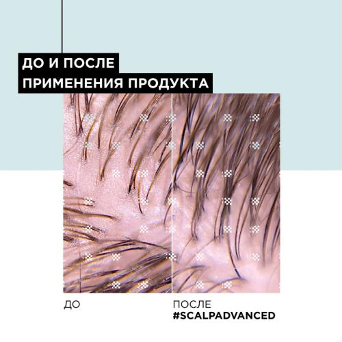 Лореаль Профессионель Шампунь Scalp Advanced для жирных волос, 300 мл (L'Oreal Professionnel, Уход за волосами, Scalp Care), фото-6