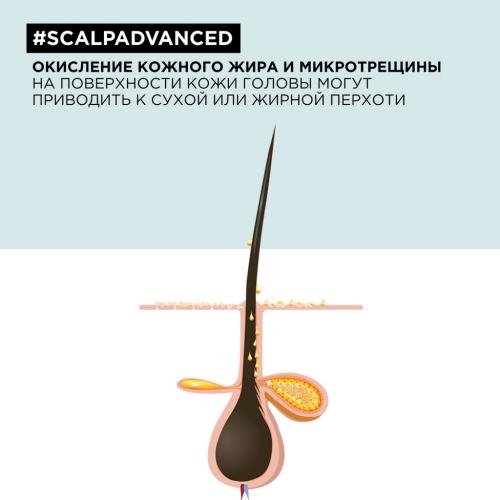 Лореаль Профессионель Шампунь Scalp Advanced против перхоти для всех типов волос, 300 мл (L'Oreal Professionnel, Уход за волосами, Scalp Care), фото-5