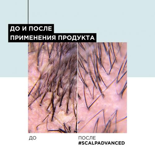 Лореаль Профессионель Шампунь Scalp Advanced против перхоти для всех типов волос, 300 мл (L'Oreal Professionnel, Уход за волосами, Scalp Care), фото-6