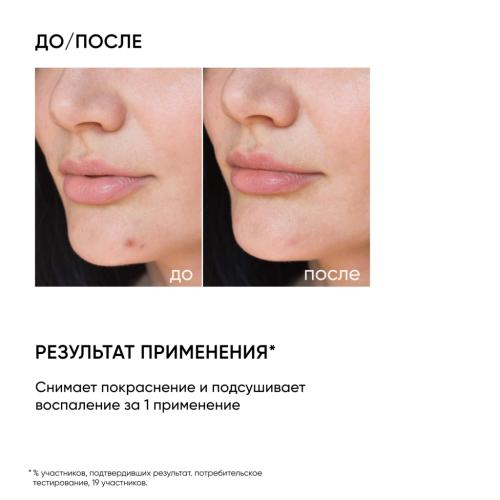 Айкон Скин Точечное SOS-средство от воспалений, 20 мл (Icon Skin, Re:Program), фото-2