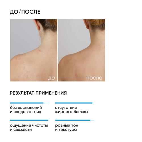 Айкон Скин Противовоспалительный очищающий гель для лица и тела Blemish Control, 250 мл (Icon Skin, Re:Program), фото-2