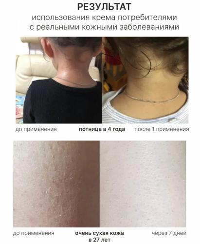 ТерафитоАбель Ультраувлажняющий крем Cure Cream 0+, 80 мл (TheraphytoAbel, Theraphyto), фото-9