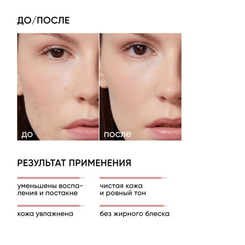 Айкон Скин Корректирующая крем-сыворотка на основе 10% азелаиновой кислоты, 50 мл (Icon Skin, Re:Program Delicate), фото-2
