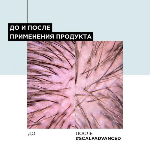 Лореаль Профессионель Зимний набор Scalp Advanced для чувствительной кожи головы (шампунь 300 мл + смываемый уход 200 мл) (L'Oreal Professionnel, Уход за волосами, Scalp Care), фото-11