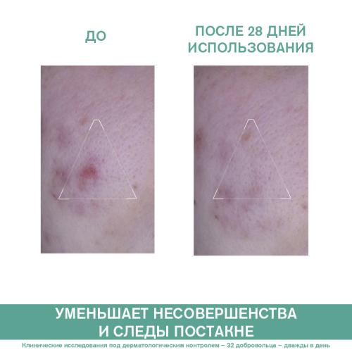 Урьяж Универсальный уход против несовершенств кожи 3 Regul+, 40 мл (Uriage, Hyseac), фото-3