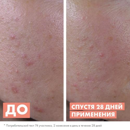 Авен Обновляющая сыворотка для жирной и комбинированной кожи, 30 мл (Avene, Cleanance), фото-5