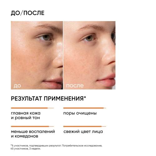 Айкон Скин Отшелушивающий тоник с миндальной кислотой, 150 мл (Icon Skin, Smart), фото-2