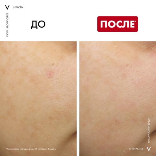 Виши Ночной крем B3 с ретинолом против пигментации и морщин, 50 мл (Vichy, Liftactiv), фото-7