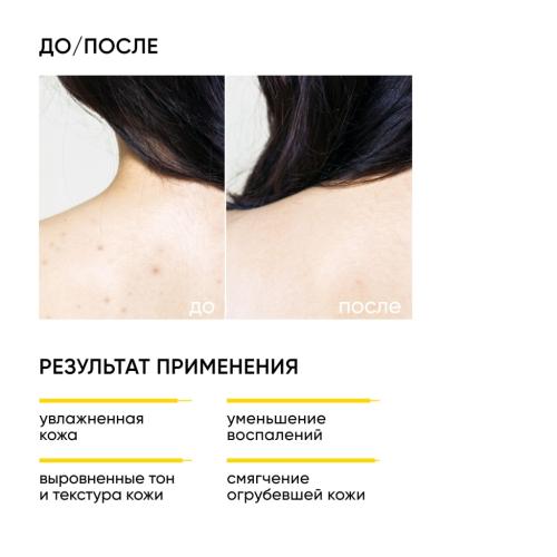 Айкон Скин Обновляющий крем для тела с кислотами Skin Renewal, 200 мл (Icon Skin, Smart), фото-2