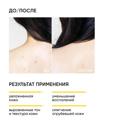 Айкон Скин Обновляющий крем для тела с кислотами Skin Renewal, 200 мл (Icon Skin, Smart), фото-3