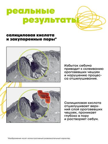Де_Код Лосьон против черных точек, 150 мл (De_Code, Clear Key), фото-9