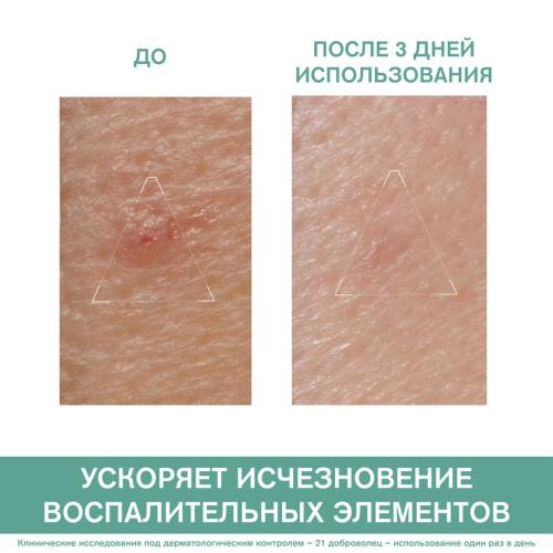 Урьяж Паста SOS-Уход, 15 г (Uriage, Hyseac), фото-3