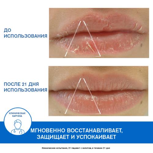 Урьяж Защищающий цика-бальзам для губ, 15 мл (Uriage, Bariederm), фото-3