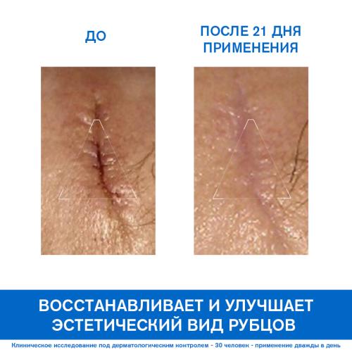 Урьяж Цика-крем с медью и цинком SPF50+, 40 мл (Uriage, Bariederm), фото-3